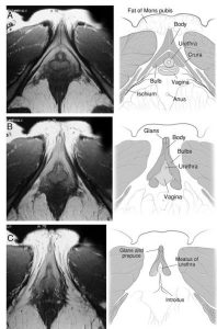 Clitoris MRI Front View Sections